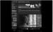 sp32-20101016-135859
